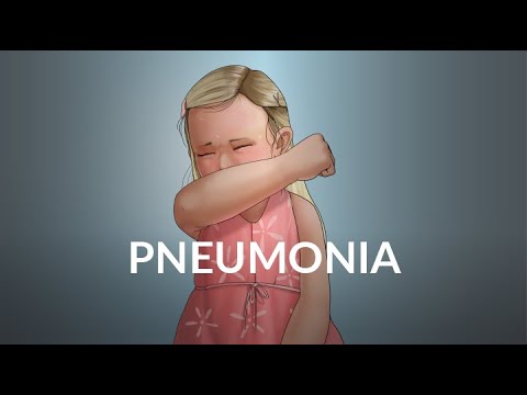 Pneumonie chez l'enfant