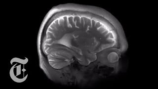 Mapping the Brain Down to .0001 Cubic Inches | The New York Times