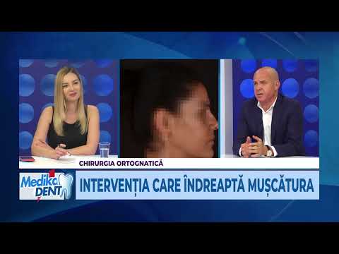 Medika Dent 18.05.2021 - Chirurgia ortognatică este chirurgia care poate rezolva afecțiuni variate