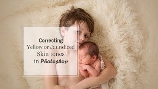 Editing Yellow or Jaundice Skin Tones in Photoshop | A Tutorial
