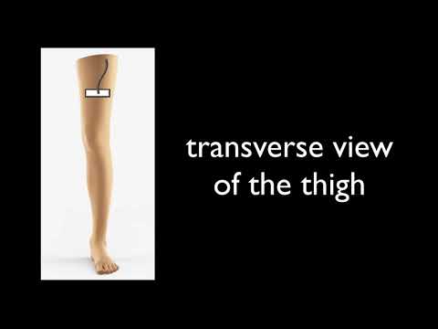 Emergency Ultrasound: Sixty Second Pearl - Question 19th June