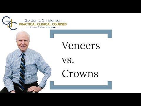 Veneers vs crowns?