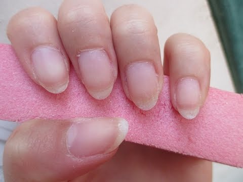 Eczema di mani nazionali Lapertura ultima in cura di psoriasi