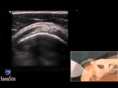 пинР° Ñ € вÐμÑ Ð½Ð ° Ñ Ð ± оР»NOE Spondylose deformans und Osteochondrose