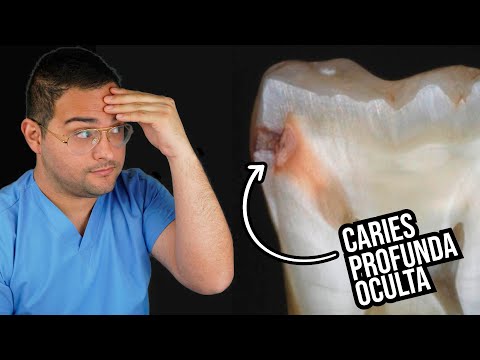 download lagu mp3 mp4 Muela Picada, download lagu Muela Picada gratis, unduh video klip Muela Picada