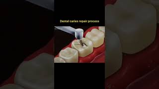 rotten tooth care teeth cleaning #shorts #short