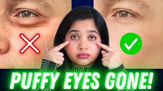 👀 How to Get Rid of Eye Puffiness and Under Eye Bags?