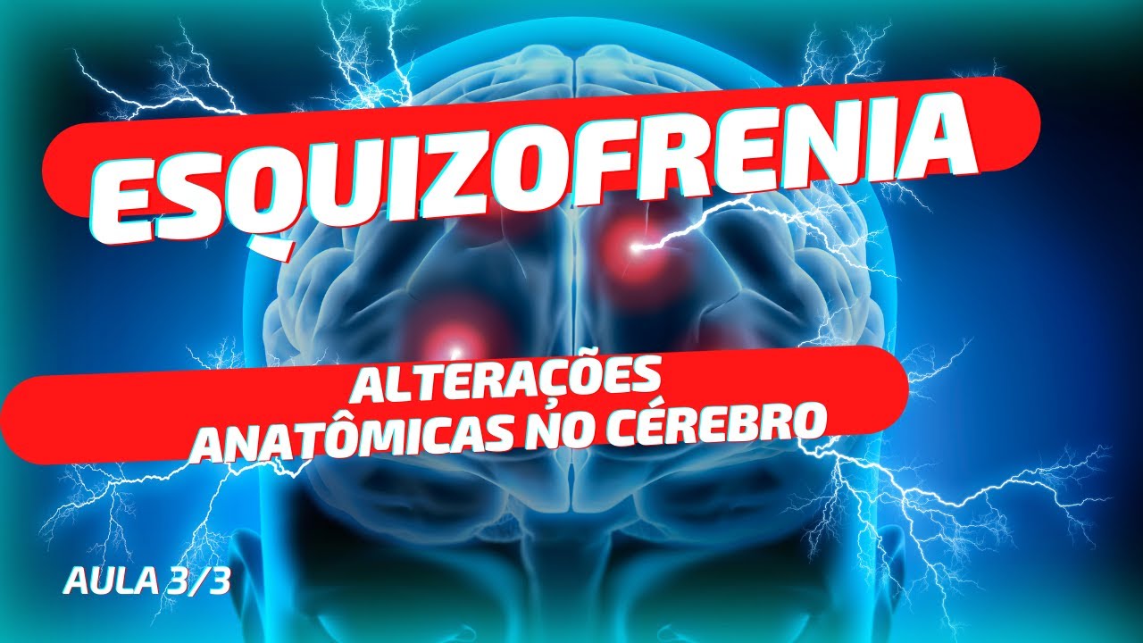 Playlist Esquizofrenia - Aula 3(de 3) ALTERAÇÕES ANATÔMICAS NO CÉREBRO