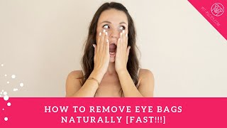 How To Get Rid Of Eye Bags Naturally [Super Fast Effective Face Yoga Technique Inside]