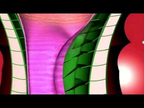 Das sind die Ursachen für Hämorrhoiden