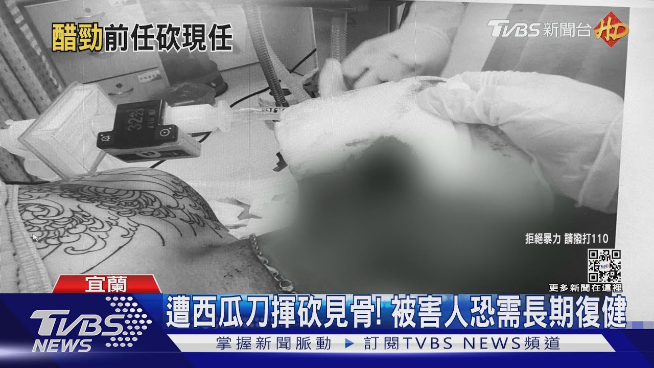 出來講!感情糾紛談判 男遭惡煞揮砍見骨恐需長期復健