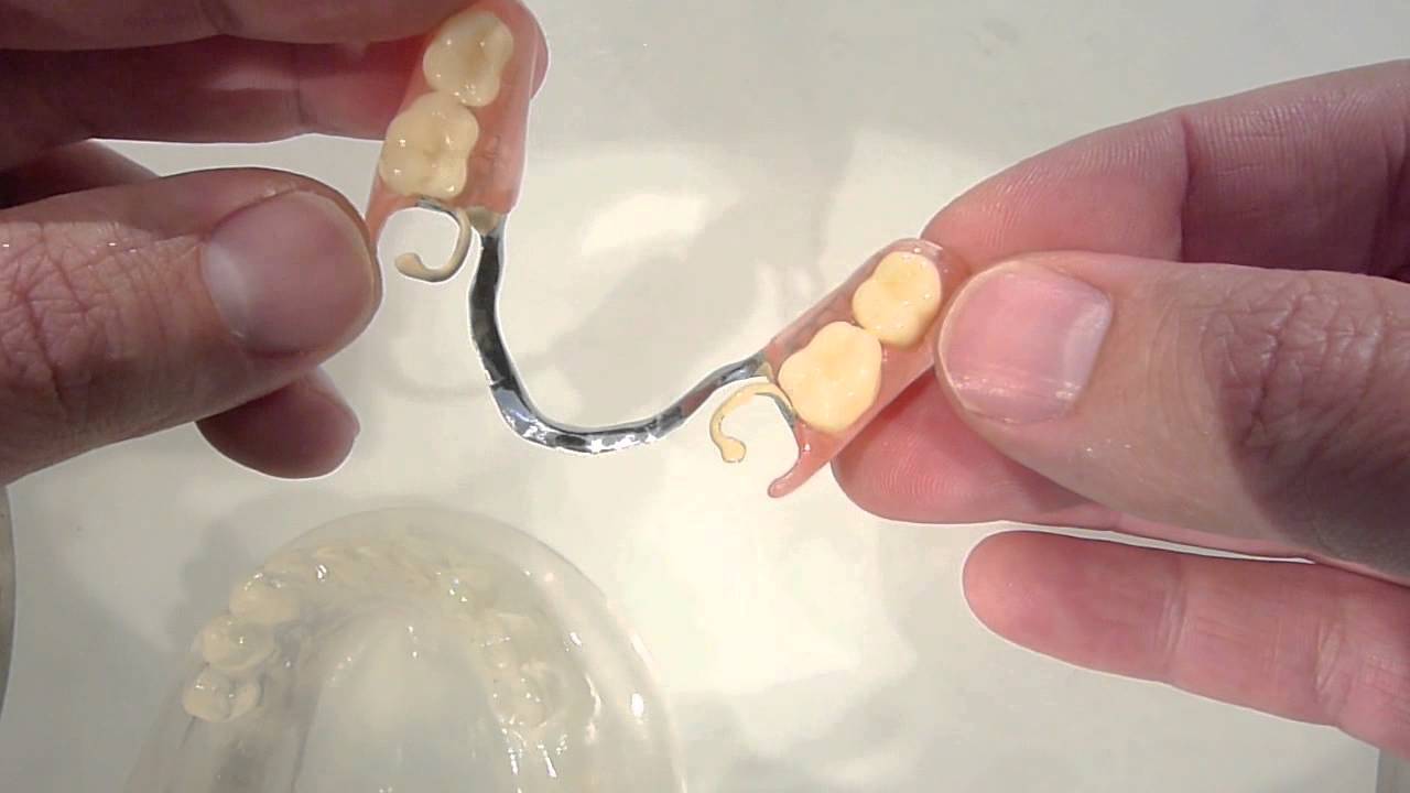 Acron + metal dół