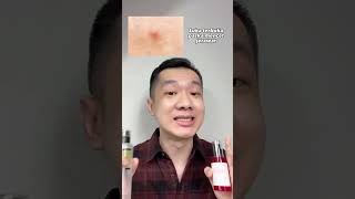 Download lagu BATTLE SNAIL MUCIN COSRX ESSENCE VS. SOMEBYMI SERUM FOR BREATHY, POCKET-PRONE, ANTI-AGING SKIN! mp3 Download lagu BATTLE SNAIL MUCIN COSRX ESSENCE VS. SOMEBYMI SERUM FOR BREATHY, POCKET-PRONE, ANTI-AGING SKIN! mp3