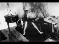 Spontaneous Human Combustion ... is it Fake or Do we Finally Understand the Cause