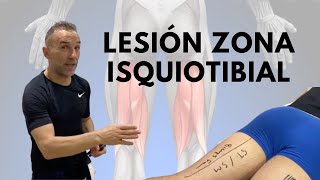 Cómo saber los centímetros de una lesión de la zona isquiotibial y tratamiento