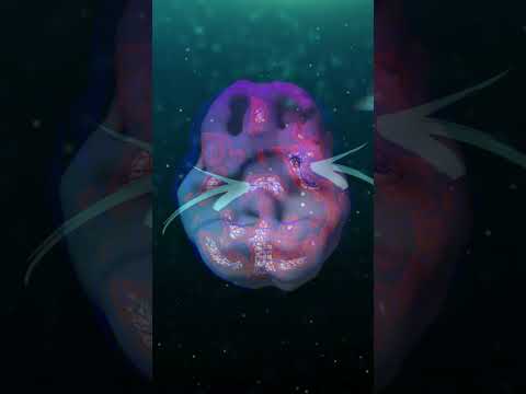 Have You Heard Of SPECT Scans?