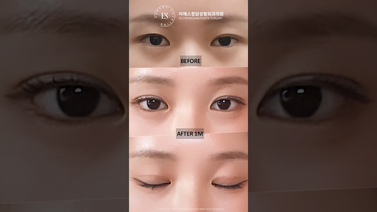 이에스 유튜브