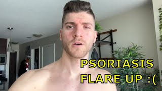 Psoriasis Flare Up - Now What…