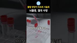 브라질 40대 여성 엉덩이 성형 시술 뒤 사망…“무자격 성형” | KBS 뉴스광장 | 20180719