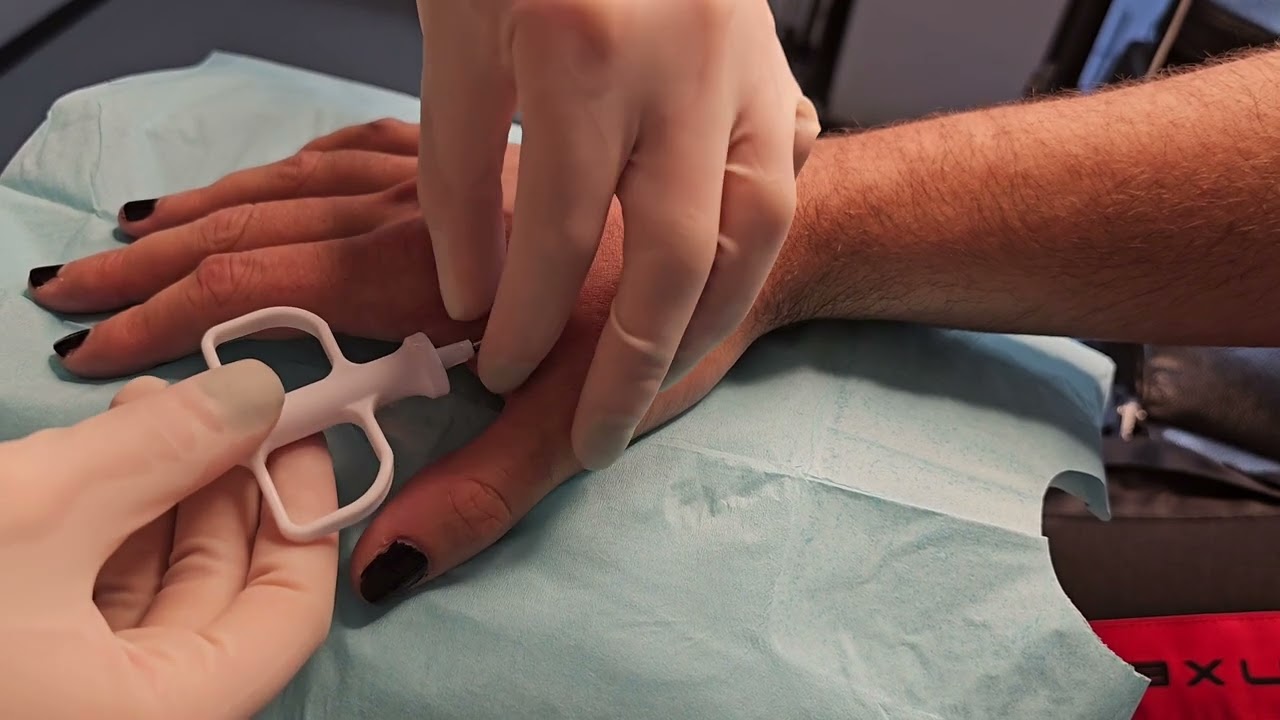 Dangerous Things xEM RFID subdermal implant  install.
