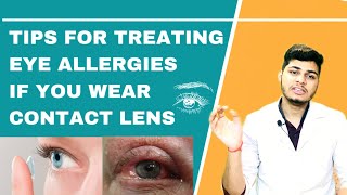 Eye Allergy contact lens |  Tips for Contact Lens Wearers With Allergies | how to use contact lens.