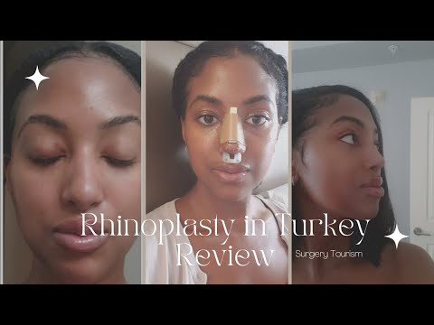 Rhinoplasty in Turkey Review