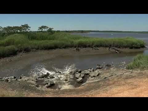 Angel Perez Amputation