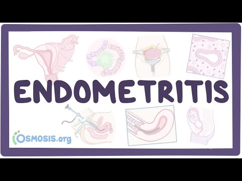 Endometritis - an Osmosis Preview