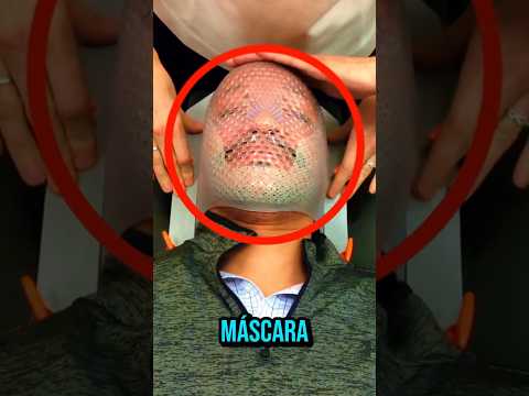 Vídeo: Para que serve: perguntas e respostas