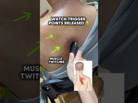 WHAT YOUR RHOMBOID PAIN IS LOOKING FOR 🤩🤩🤩 #rhomboids #scapularpain #backpain #viralvideo