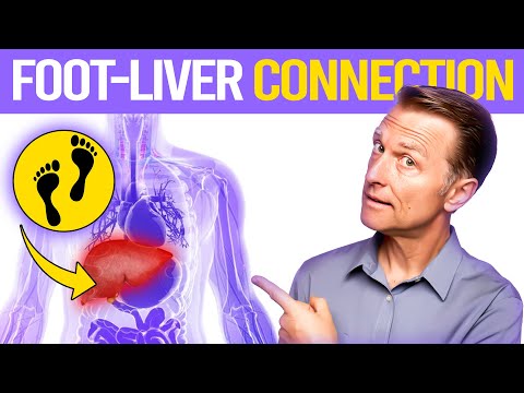 How Your Feet Are Warning You About Your Liver Problems Dr Berg Explains