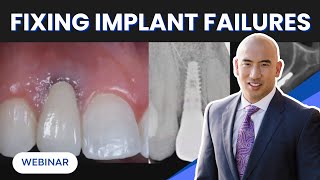 When Implants Fail: Fixing Complications in the Smile Zone