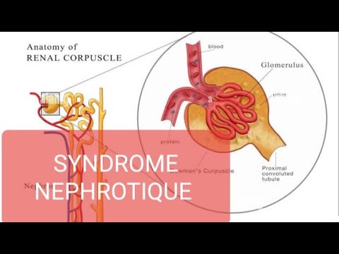 SYNDROME NEPHROTIQUE ( cours bien organisé et facile à comprendre) À NE PAS RATER!
