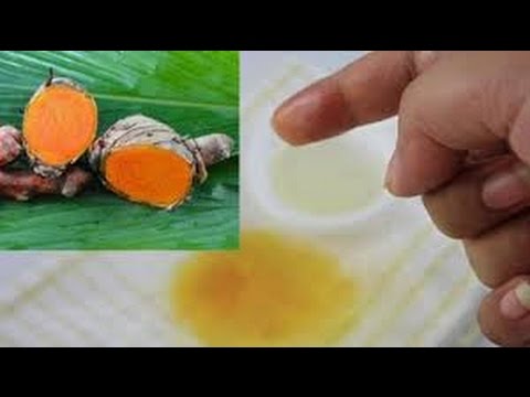 Kulit kendur setelah berat badan apa yang harus dilakukan foto Seberapa cepat menurunkan berat badan dengan 10 kg di rumah selama seminggu dan hasil ulasan