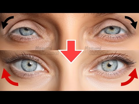 Cat Eyes Lift Massage! How To Create Fox Eyes/Cat Eyes Naturally, Get Bigger Eyes, Fix Droopy Eyelid