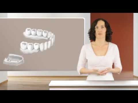 Die Reinigung des Teleskops