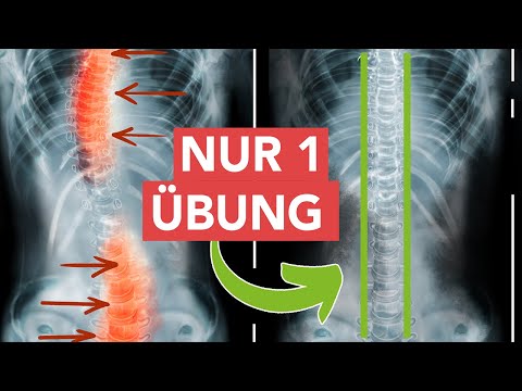 Spinal stabilization with just 1 exercise