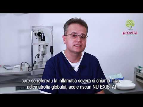 tratamentul laser al varicozei varicoze în krivoy rog varicose front