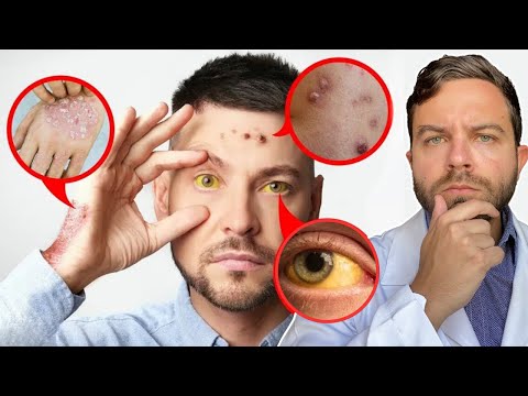 10 Things Your SKIN Tells About Your LIVER