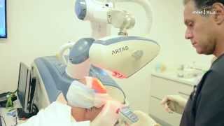 Dr Touma on Artas robotic hair transplants