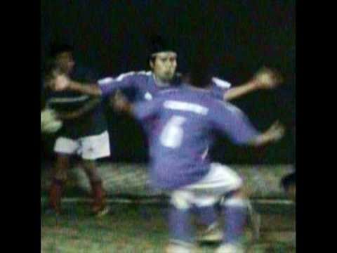 Carlos Poma (LITO) fractura de tibia y perone.