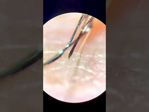 顕微鏡下で生きている間に蚊が私の手を刺しました！