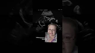 Ultrasound and glucose test today