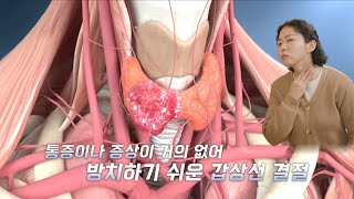원주 성지병원과 함께하는 건강캠페인 [갑상선결절] 편 #원주성지병원 #문진수전문의 #갑상선결절