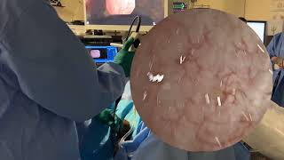 Core Videos (2025): Flexible Cystoscopy Step by Step Video Guide