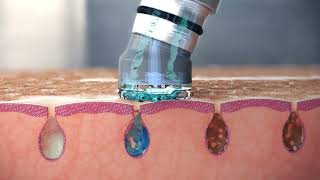 AquaShine. Único sistema de cuidado facial inteligente