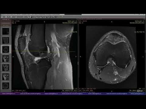 Lecția de genunchi 14