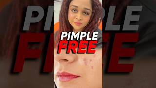 പിമ്പ്ൾസ് ഉള്ളവർ ഇത് ഉപയോഗിച്ച് നോക്കൂ | Pimple Patches | Explore Beauty With Ash #shorts #youtube