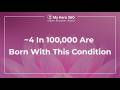 This Is the Most Common Form of Dwarfism | The Achondroplasia Series Thumbnail