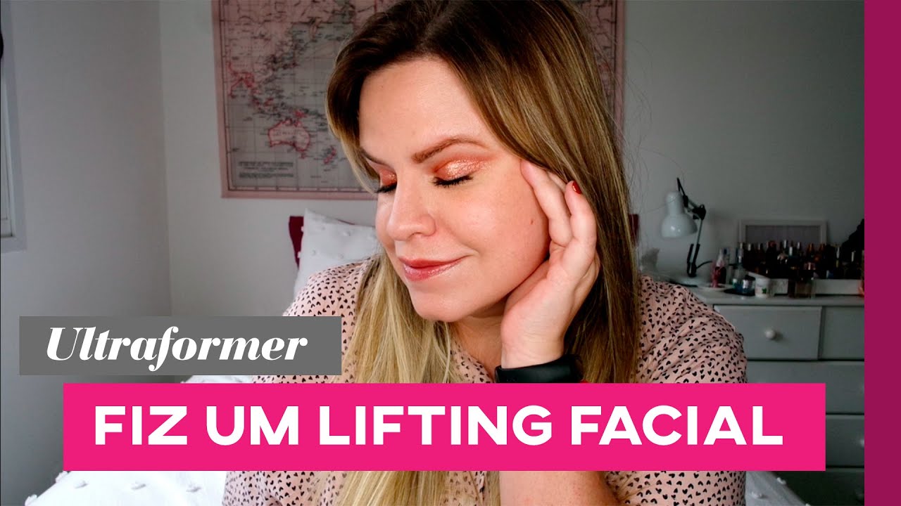 Minha experiência com ULTRAFORMER: procedimento de estímulo de colágeno | Marina Fabri